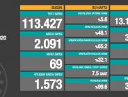 CORONAVİRÜS TABLOSUNDA BUGÜN (24.10.2020)